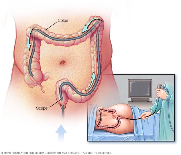 Best Gastroenterologist in Max Super Speciality Hospital patpargan