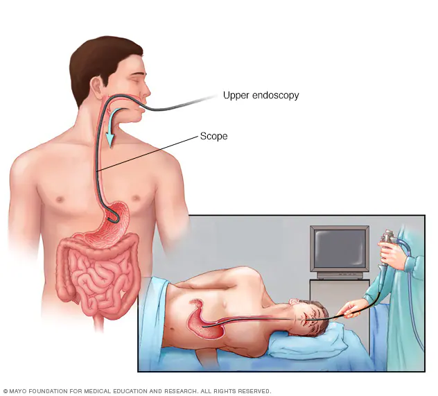 Best Gastroenterologist in Max Super Speciality Hospital patpargan